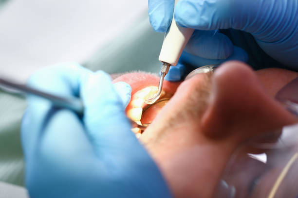 Best 24-Hour Emergency Dental Care in Hlsboro, IL